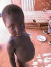 AUT_3403 Bani. One of the many malnutritioned kids.JPG (73913 byte)